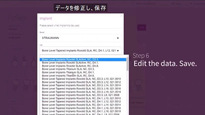 インプラント情報のデータ修正