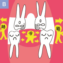 口腔機能発達不全症