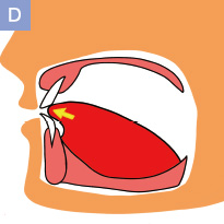 口腔機能発達不全症