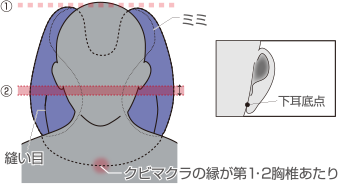 クビマクラ設置のイメージ