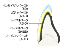 レジン層0.8mmの場合のイメージ