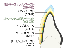 レジン層0.5mmの場合のイメージ