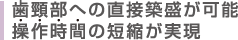 歯顎部への直接築盛が可能 操作時間の短縮が実現