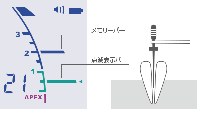 [図] 点滅表示バー／メモリーバー