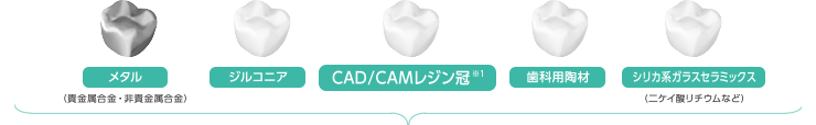 メタル（貴金属合金・非貴金属合金）／ジルコニア／CAD/CAMレジン冠※1／歯科用陶材／シリカ系ガラスセラミックス（二ケイ酸リチウムなど）のイラスト