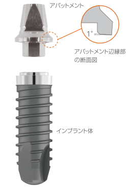 SPI®システムのインプラント