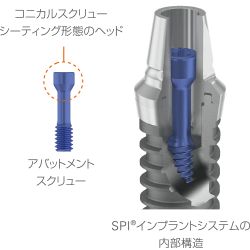 SPI®インプラントシステムの内部構造