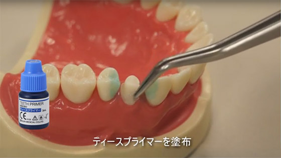 操作ステップの動画サムネイル