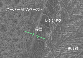 象牙質とスーパーMTAペーストの界面