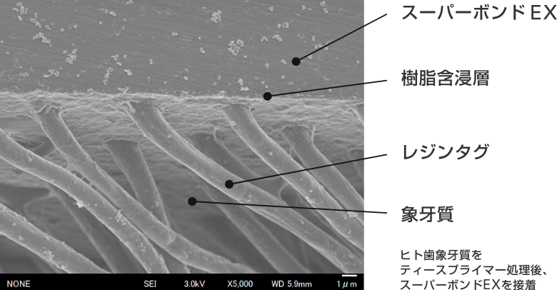 モノマー成分に含まれる4-METAが歯質に浸透して拡散し、良質な樹脂含浸層とレジンタグを形成します。