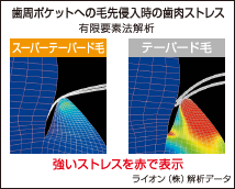 歯周ポケットへの毛先侵入時の歯肉ストレス