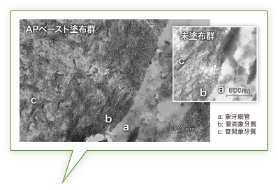 HApの拡大イメージ