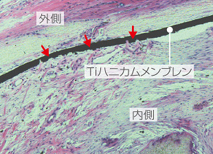 Tiハニカムメンブレン内側のイメージ