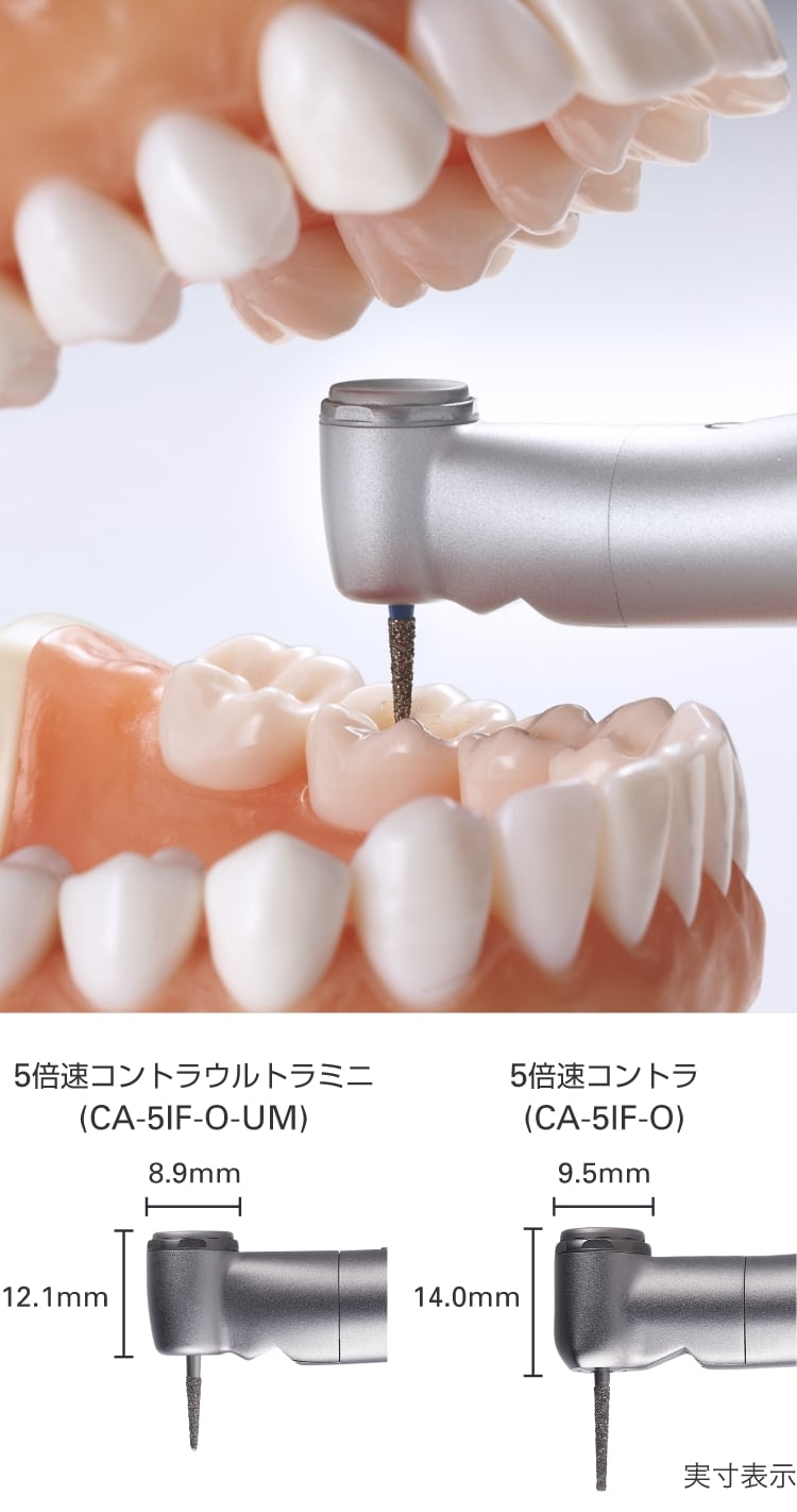 ウルトラミニヘッドの優れた操作性