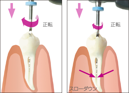 オートトルクスローダウン