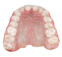 歯の写真イメージ