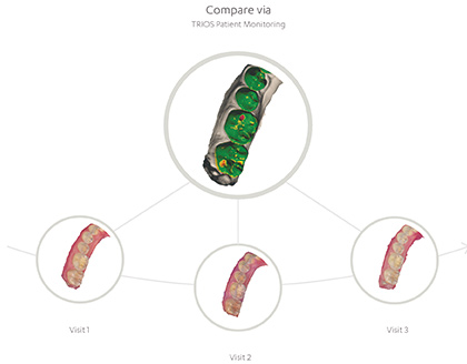 TRIOS Patient Monitoring