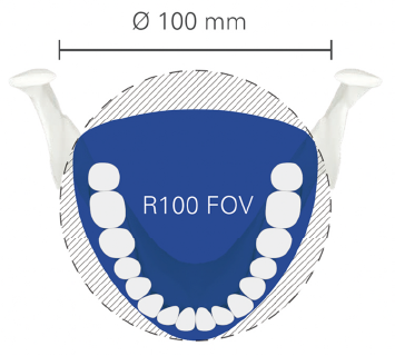 Dental Arch FOV