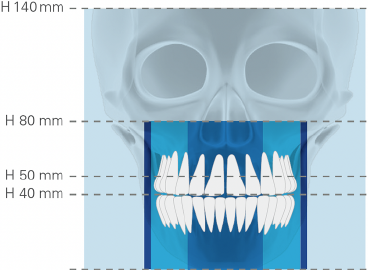 Dental Arch FOV