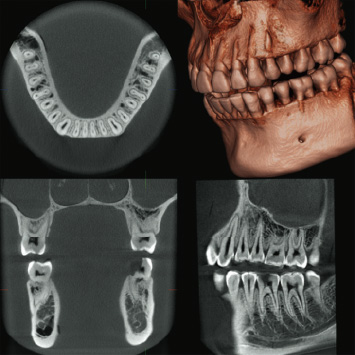 Dental Arch FOV Φ80×H80mm