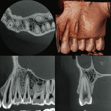 Dental Arch FOV Φ40×H40mm