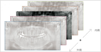 1.断層撮影により得られる複数の画像