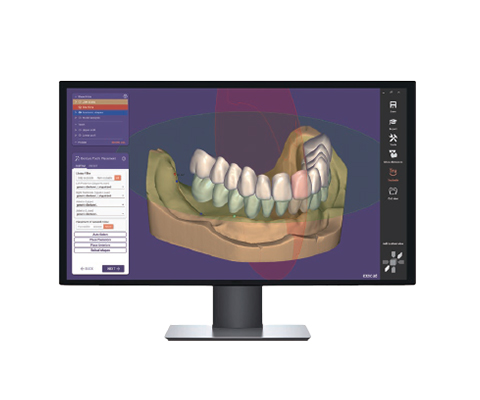 [写真] DentalCAD
