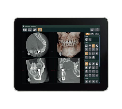 [写真] i-Dixel WEB 3D
