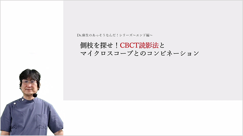 第2章 側枝を探せ！CBCT読影法とマイクロスコープとのコンビネーション サムネイル