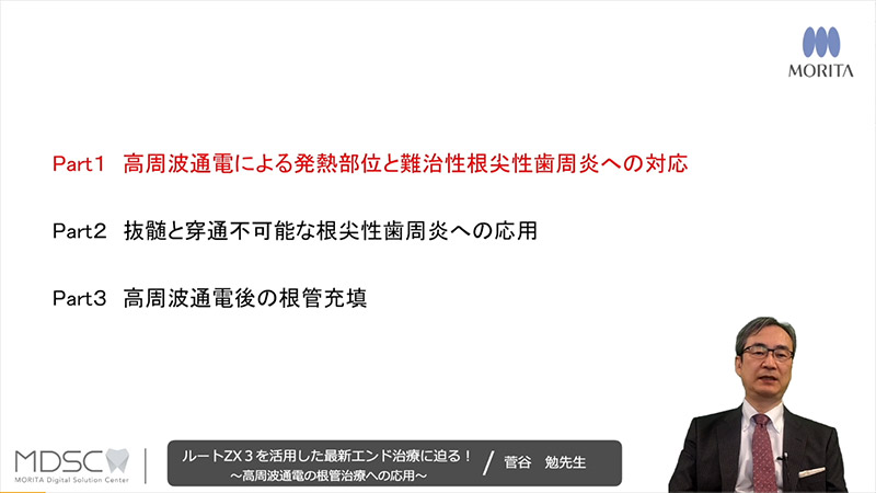 [サムネイル] Part１　高周波通電による発熱部位と難治性根尖性歯周炎への対応