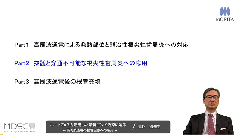 [サムネイル] Part２　抜髄と穿通不可能な根尖性歯周炎への応用