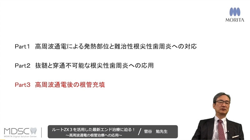 [サムネイル] Part３　高周波通電後の根管充填